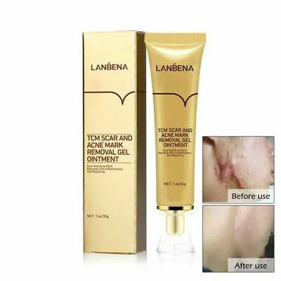 lanbena-tcm-scar-and-acne-mark-removal-cream-big-2